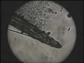 Leukocytes attacking a splinter