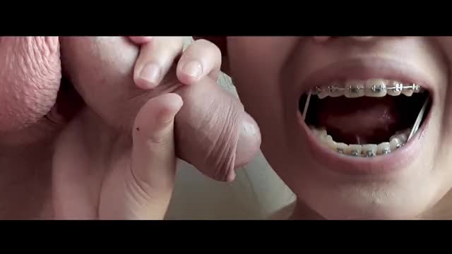 Asian with braces elastics sucks white cock and foreskin [OC]