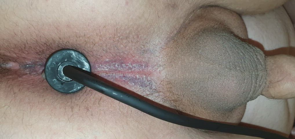 Mini prolapse and gape