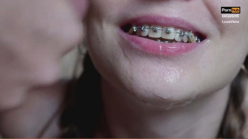 Lucasvilena Cum on Braces 1