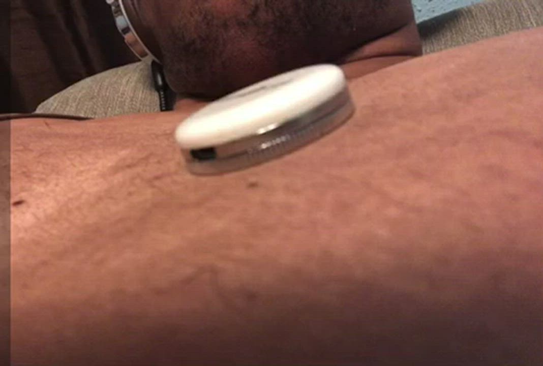 African American Ebony Medical Medical Fetish gif