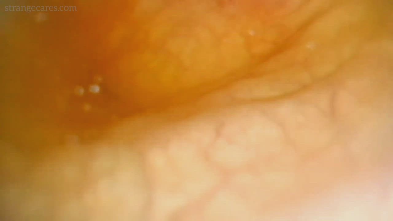 my current favorite endoscopy video- a new way to watch double penetration!