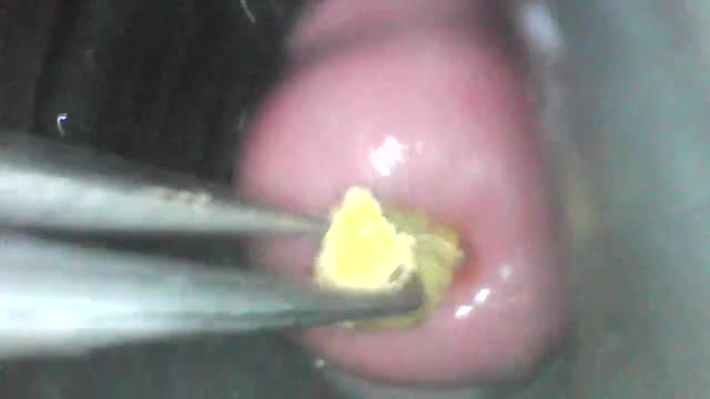 fucking my cervix with ginger