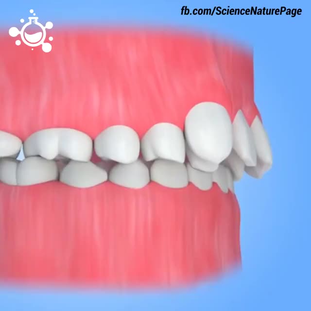 Common Dental Procedures