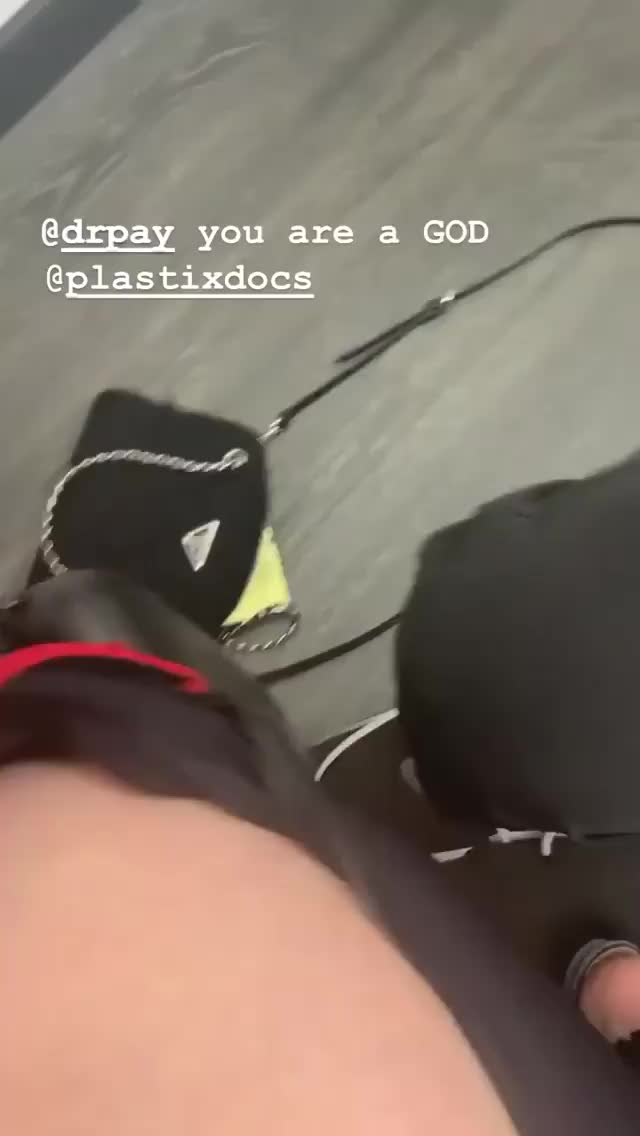 Julia Fox - 1/23/20 Instagram Story re tattoo removal