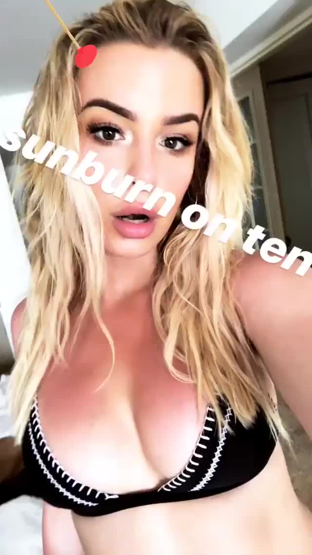 Tana Mongeau Sunburnt