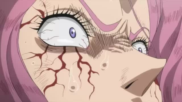 Black Clover - S1 E64 W6