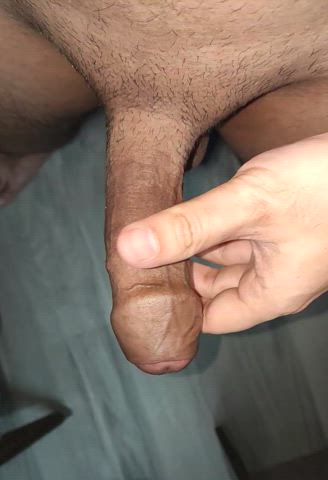 (29) Retracting skin to expose glans.