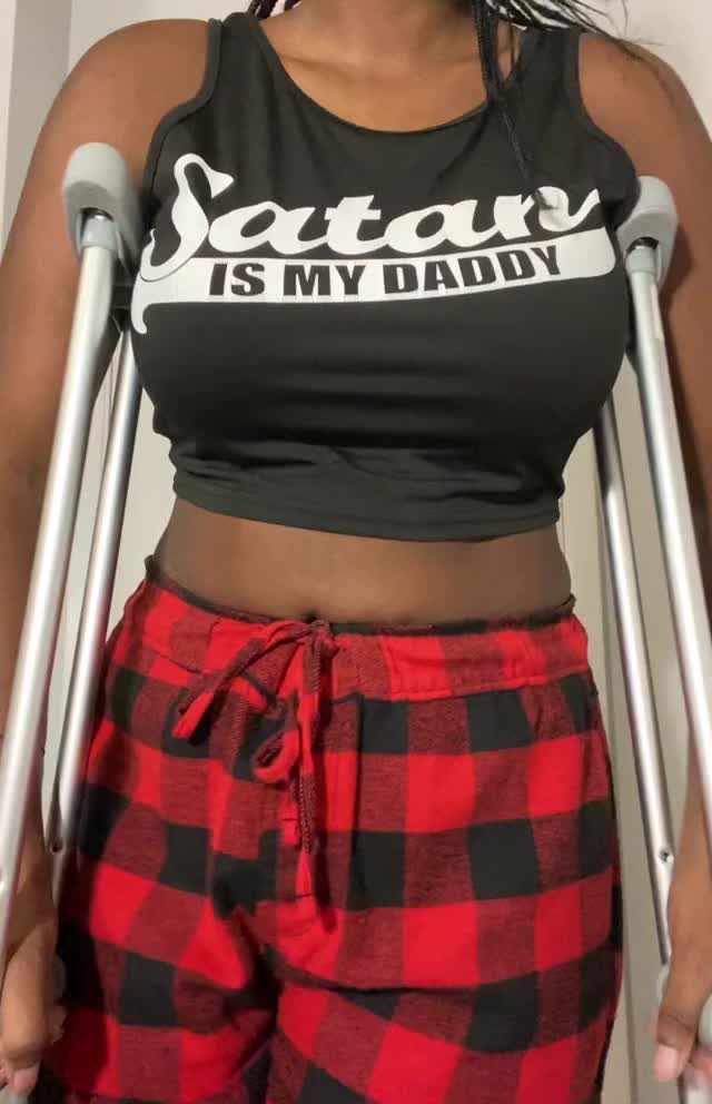 Not even a broken leg can stop me from showing all of reddit my tits :P