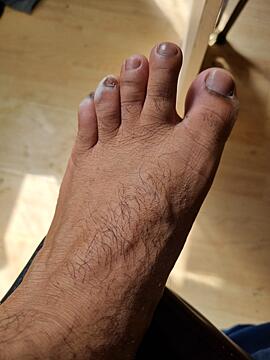 Do you want to see ugly feet pictures and videos