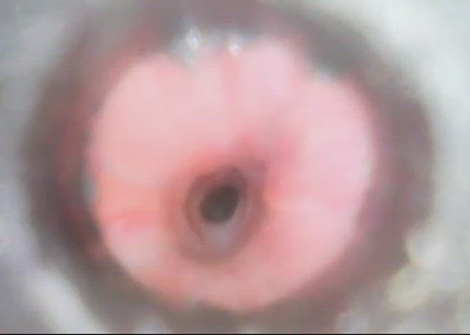 REMOVING CAMERA FROM URETHRA. As requested. Part 1 posted yesterday