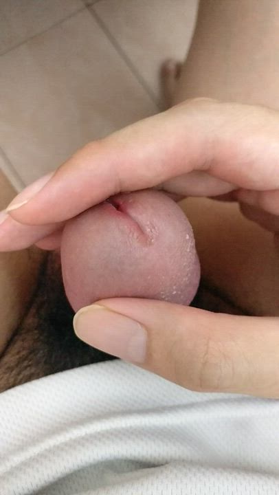 Feeling horny after I didn't cum for more than 3 weeks due to circumcision procedure.