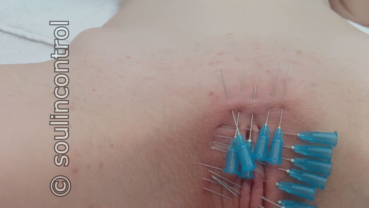 [OC] My girlfriend wanted to try having her vagina pierced shut. This was very painful