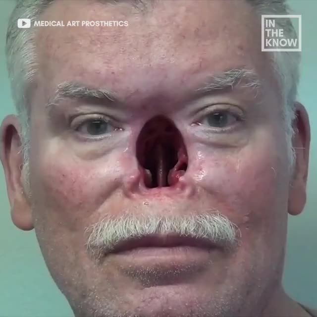 Amazing prosthetics