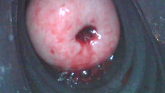 clit pump on my menstruating cervix