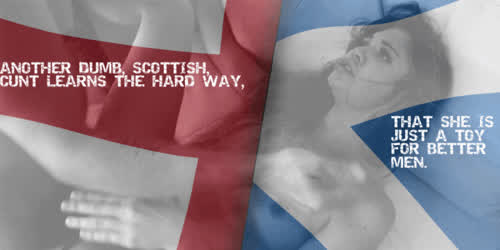 She's Scottish, she doesn't deserve rights.