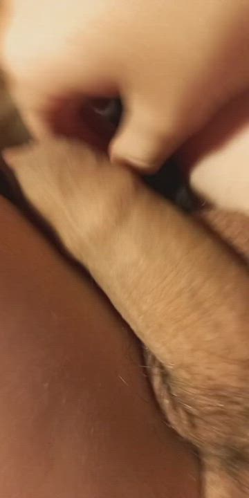 18yo Foreskin pulled back