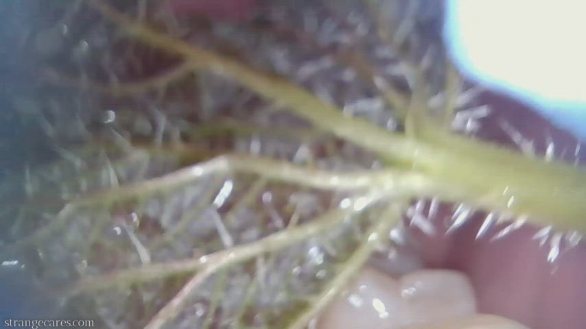 closeup of stinging nettles on my tongue and uvula