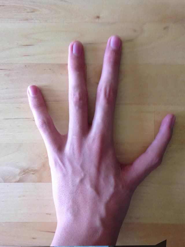 Hand XRay