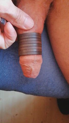 Retracting my foreskin using rings