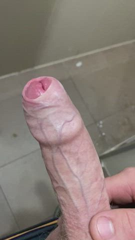 Who loves a foreskin peel?