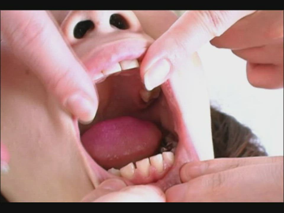 Woman gets her teeth checked