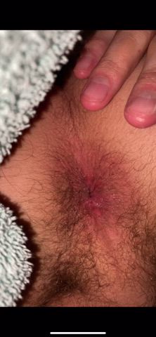 [31] this hole needed some attention last night