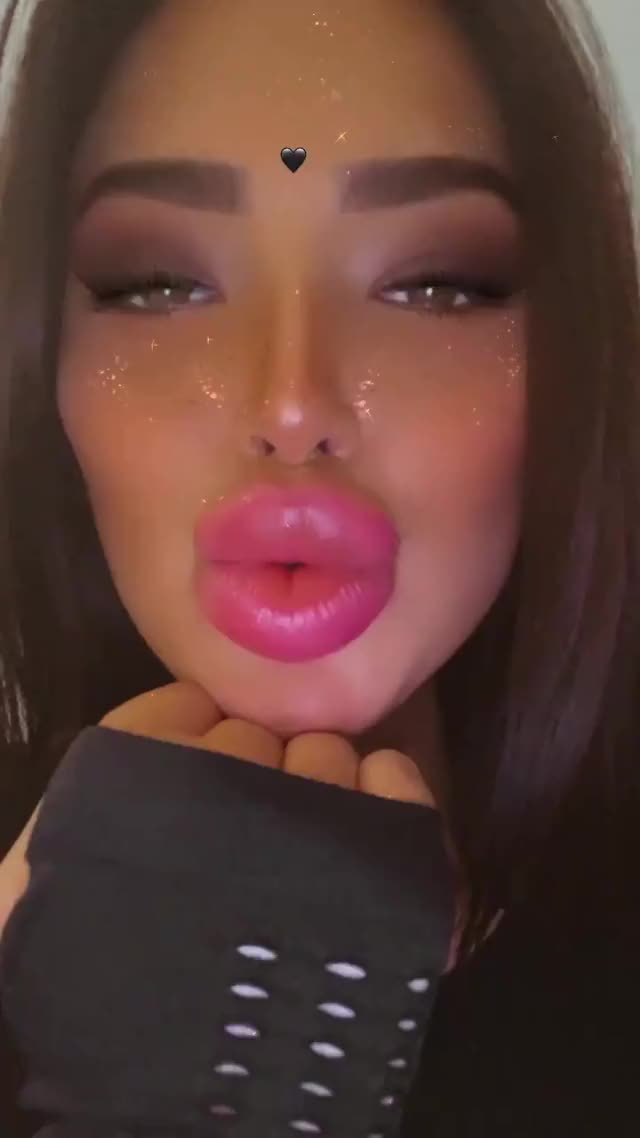 Kisses