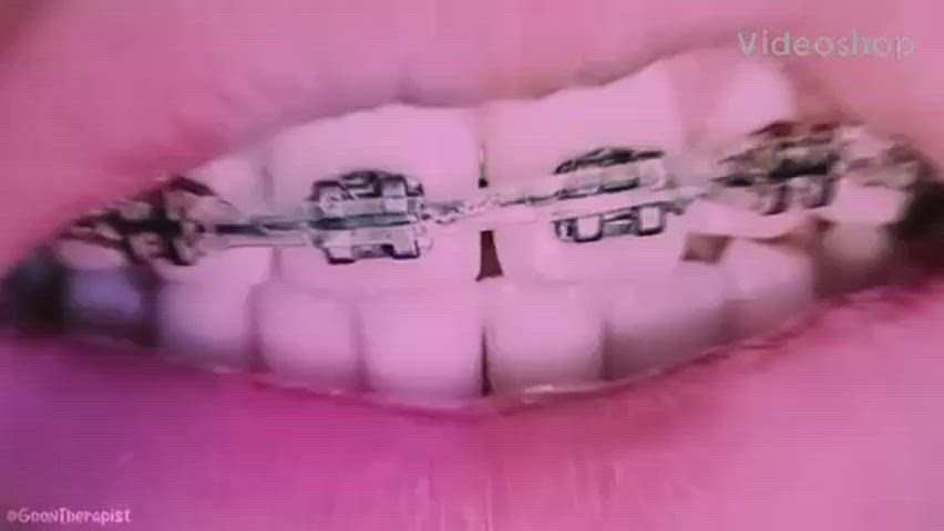 braces cumshot teen gif