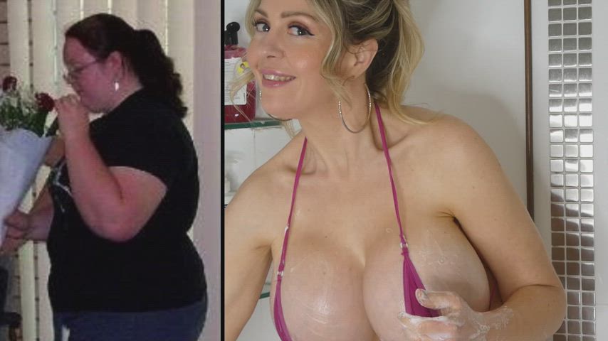 My before and after bimbofication - weight loss, lasix, brachioplasty, abdominoplasty,