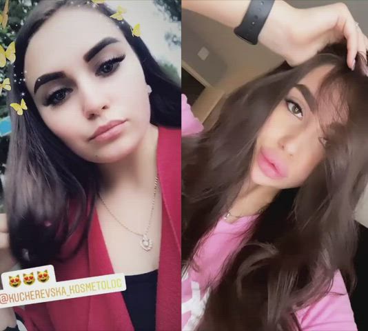 Ukrainian cute teen got addicted to fillers and gets huge Dick Sucking Lips