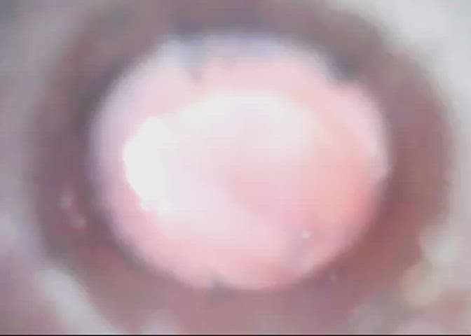 CAMERA IN URETHRA AFTER A GOOD SESSION