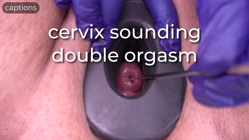 cervix sounding