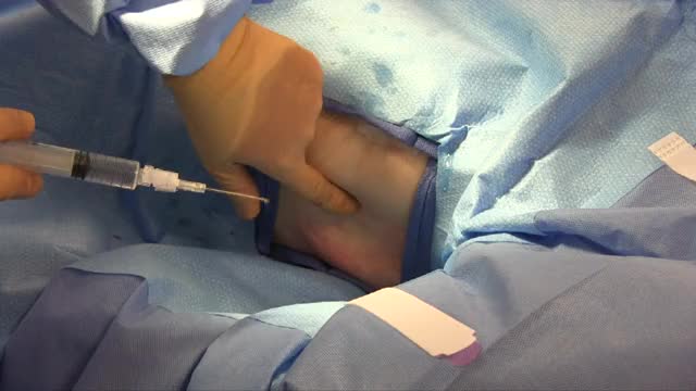 Chest Tube Anesthesia