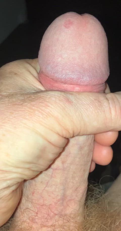 foreskin pulled back