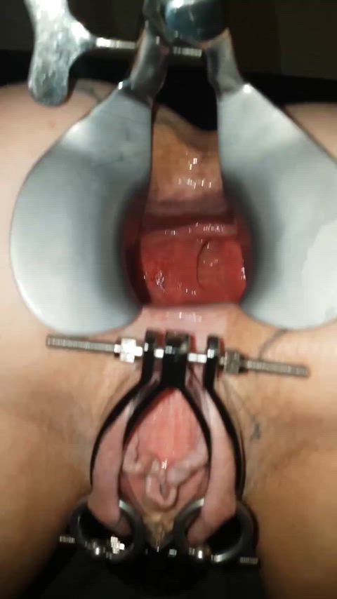 anal speculum ass spread close up pussy spread gif