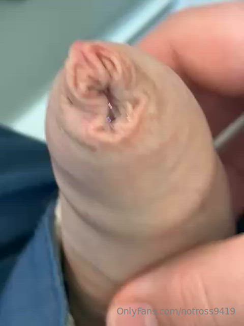 leaking in my foreskin (39)