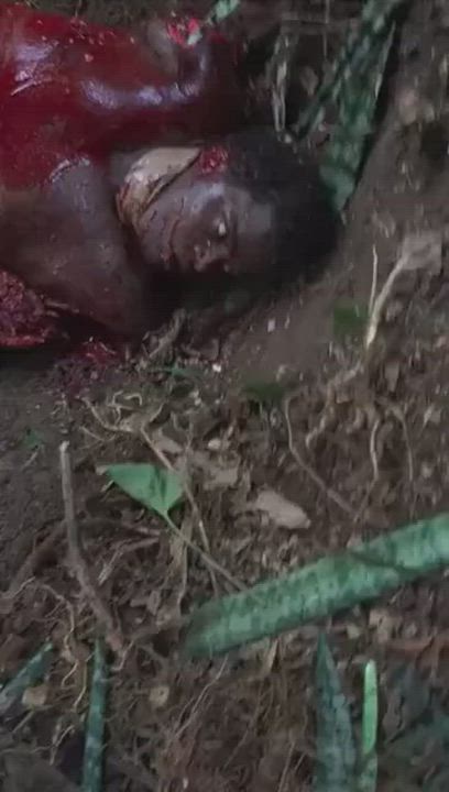 Mutilation of a congolese woman