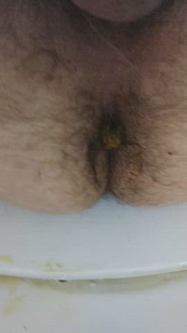 Desperate diarrhea explosion