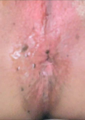 My raw lips wanna say hi! #linkincomments