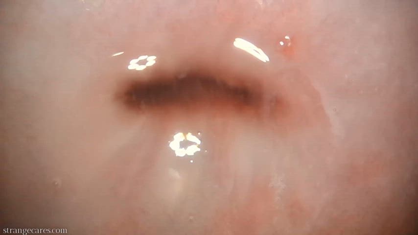 cervix closeups